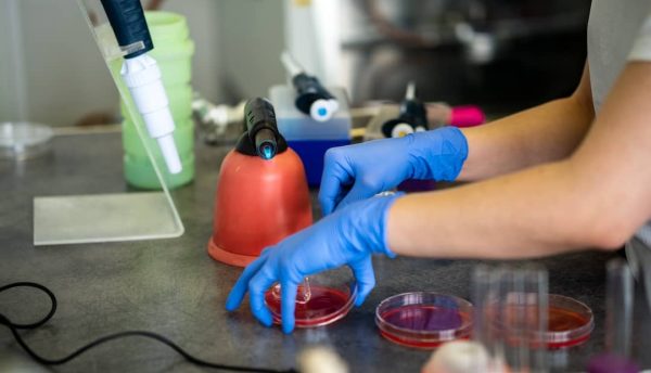 nurse-using-test-tubes-for-the-new-rapidly-spreadi-2023-11-27-05-35-03-utc